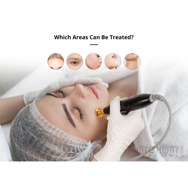 4-in-1 Plasma Facial Rejuvenation Device with EMS&EL
